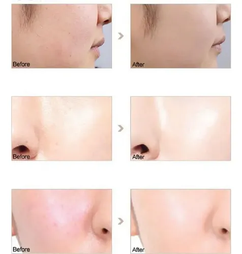 Phoera Primer Facial Hidratante 2 Piezas 6 Ml Cada Uno