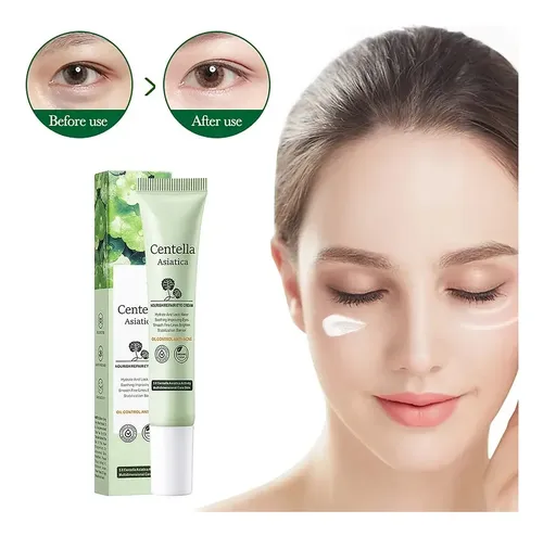 Crema Contorno Ojos Centella Asiática Antiojeras Antiarrugas Tipo De Piel Todo Tipo De Piel