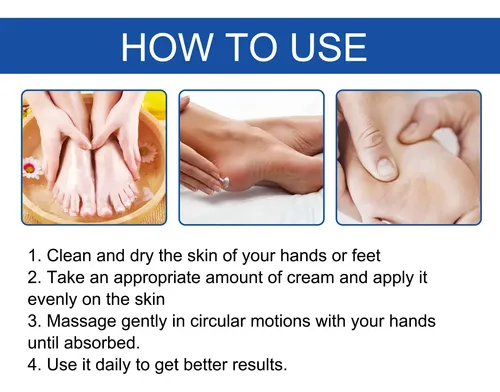 Hy/ Crema Hidratante Para Manos Y Pies Hoygi Para Piel Seca