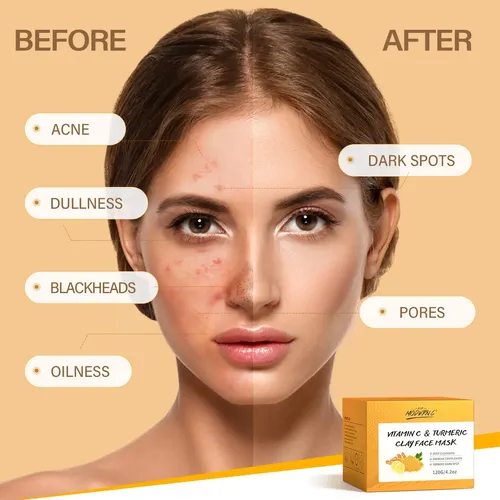 Máscara De Arcilla Vitamina C Turmeric Youzhi 200g Cuidado
