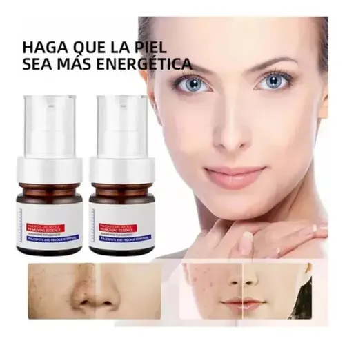 Whitening Y Freckle Eliminar La Esencia,aobenz