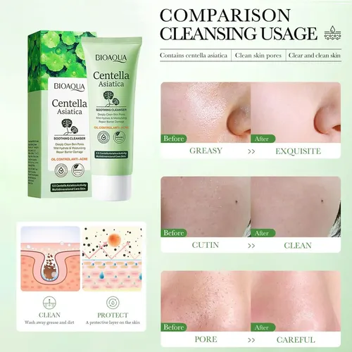 Gel Facial Espumoso Limpiador Centella Asiatica Anti Acne