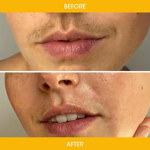 Nad’s Tiras De Cera Facial – Natural Todo Tipo De Piel – Dep