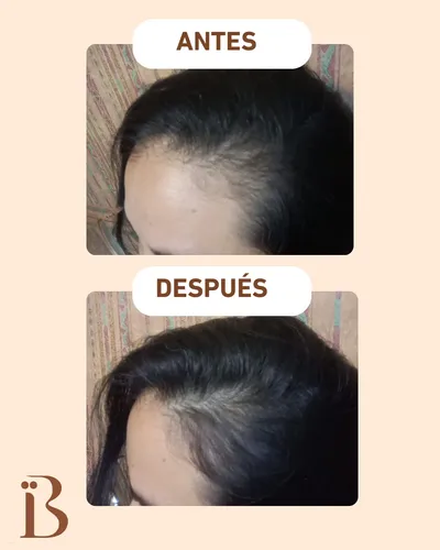 Serum Capilar Anticaída Y Reparación 2 En 1