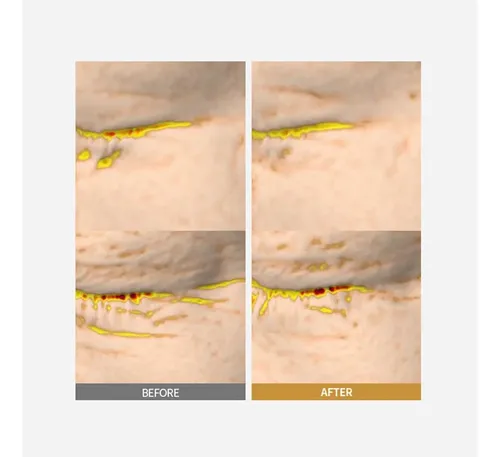 Crema Antiarrugas De Colágeno Profundo Para Reafirmar