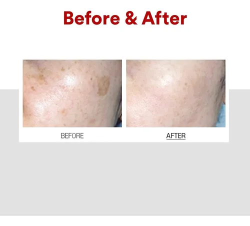 Crema Anti Manchas Medi-peel 30ml