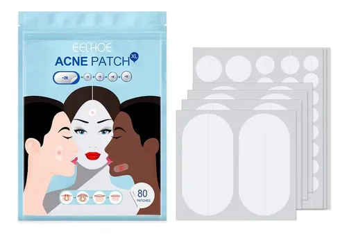 Patch Ii Pimple Acne De Tamaño Grande, 80 Unidades/juego