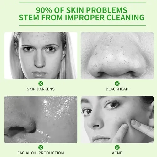 Limpiador Facial Anti-acné Elimina Impurezas Y Reduce Acné
