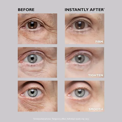 Peter Thomas Roth-tensor De Ojos Temporal/afirma Lineas Fina
