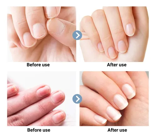 Cortauñas Eléctrico For Uñas Gruesas, 3 En 1 Automático,