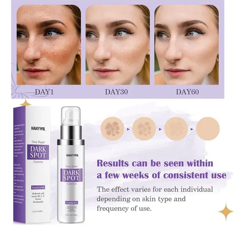Remover Manchas Oscuras Rostro Y Cuerpo 2% Retinol +