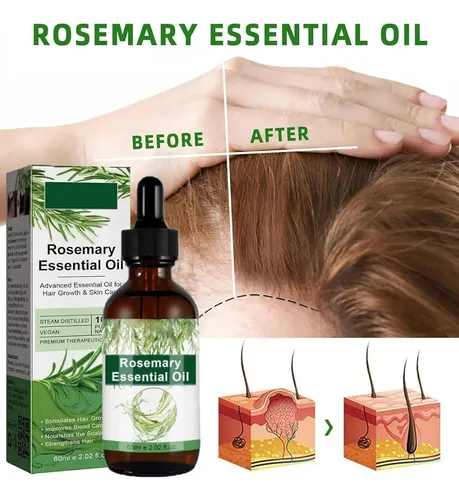 Aceite Para El Crecimiento Y Tratamiento Del Cabello Vvd Ros