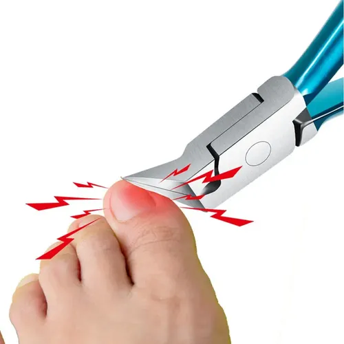 Lk Cortauñas De Pies, Podólogo, Uñas Gruesas Y Cutículas