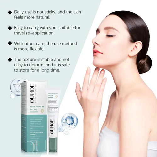 Crema De Tratamiento Para El Acné Ouhoe, Suave Y Nutritiva,