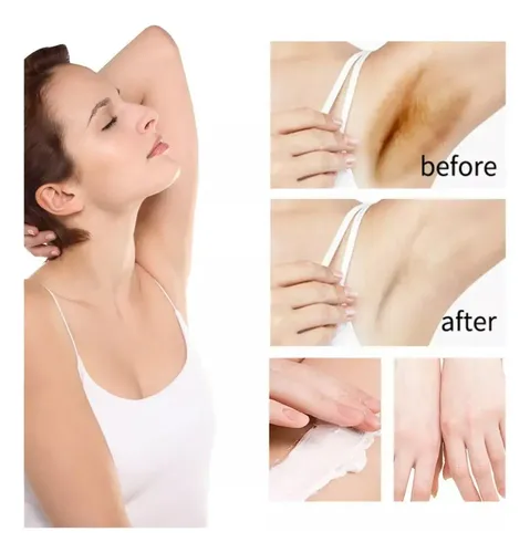 A. Crema Blanqueadora Para Áreas Íntimas 30ml Ilumina