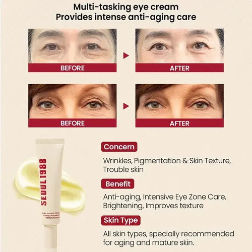 Crema Retiniana Para Ojos, Reduce Las Ojeras, Aprieta, 30 Ml Todo Tipo De Piel Día/noche