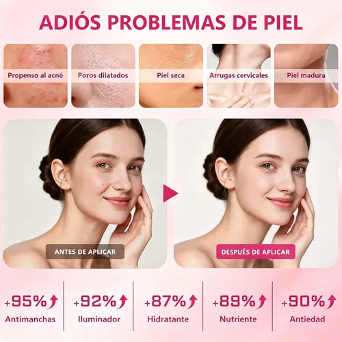 Pdrn Niacinamida Crema+sérum Antimanchas Uniforme Weud