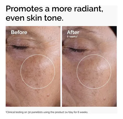 Loción Glycolic Acid 7% Toning Solution The Ordinary 240ml
