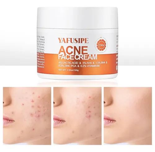 Crema Facial Para Acne Piel Sensible/brotes 3% Aha 100gr