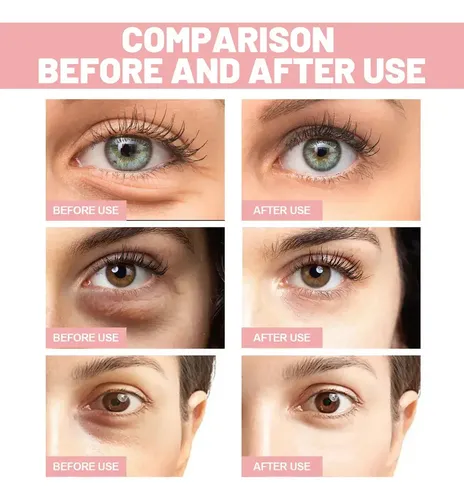 S-mz724 Parches Para Ojos, Ojeras Y Decoloración, 60