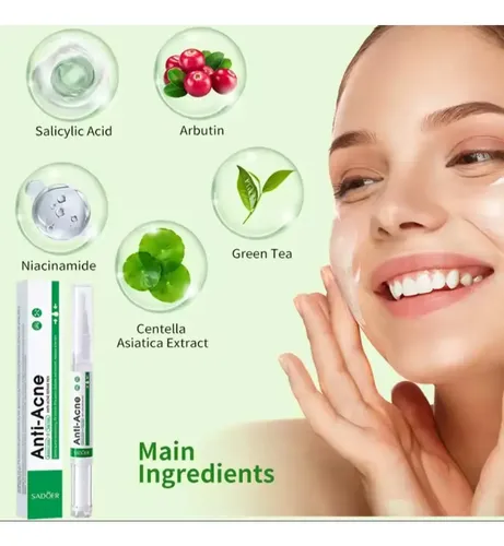 Crema Tratamiento Acne Granitos 100% Efectividad Todo Tipo De Piel Día/noche