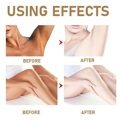 Crema Íntima Aclaradora Mslam 60 G Neutra