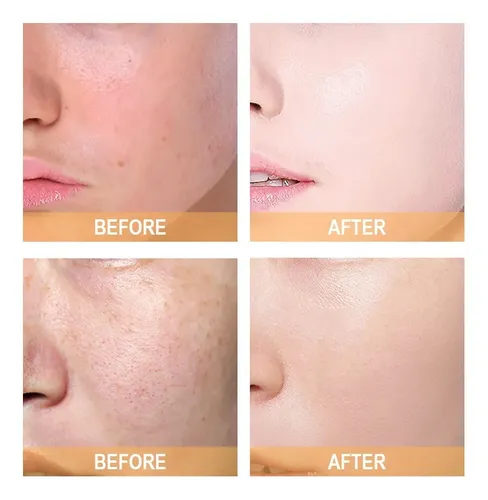 Tónico Facial Ácido Glicólico 7 Exfoliante 240ml Todo 2026,;