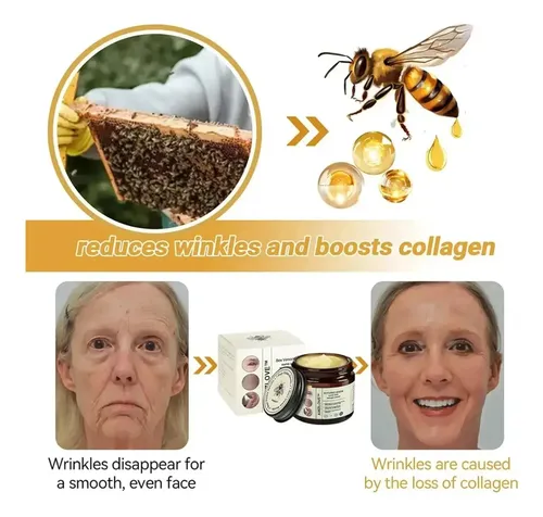 Xl Crema De Reparación Rápida De La Piel De La Abeja Awzlove