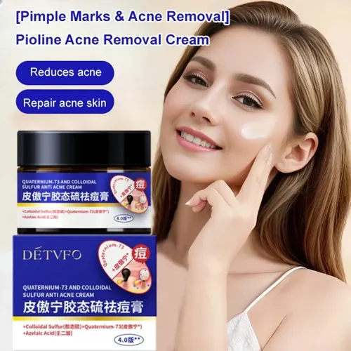 Crema Para Eliminar El Acné, Atenúa Las Marcas Del Acné, Cie
