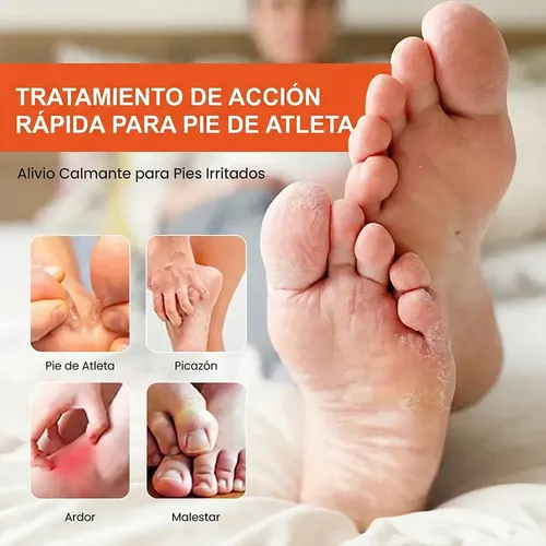 Crema Piel Pie Atleta Alivio Prolongado Picazón Uso Diario