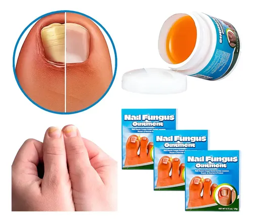 Pack 3 Cremas Reparadora Uñas Antihongos Bálsamo Reparador Fragancia Neutra