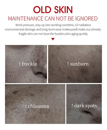 Eliminador De Manchas Oscuras, Melasma, Pecas, Manchas Solar Todo Tipo De Piel Día/noche
