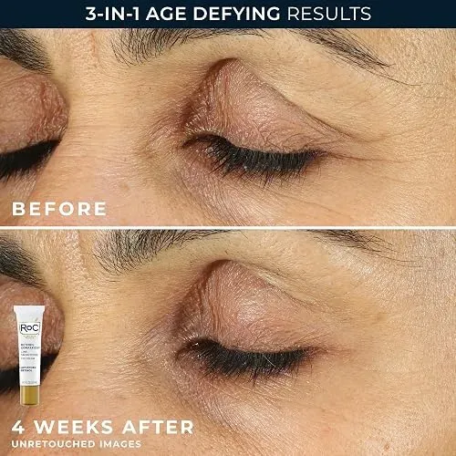 Roc Retinol Correxion Crema Para Debajo De Los Ojos Ojeras