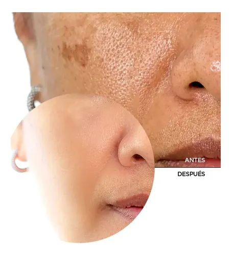 Serum Revox B77 Skintreats Activador Rejuvenecimiento