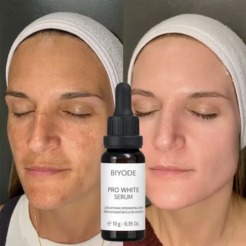 Serum Despigmentante Blanqueador Parpados Mas Parejos Todo Tipo De Piel