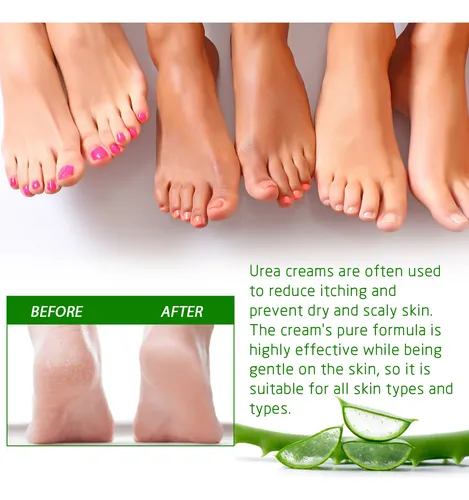 La Crema Para El Cuidado De Los Pies Eelhoe Hidrata Y Cuida