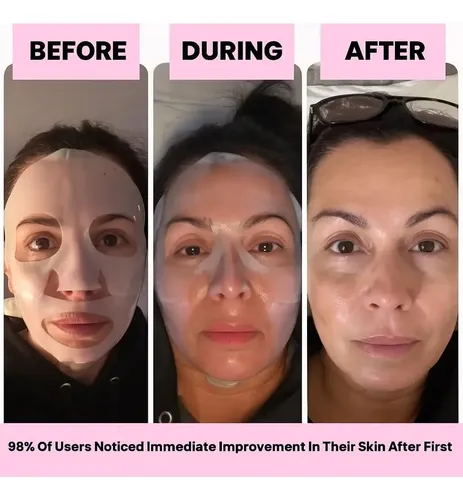 Kit 8 Mascarillas Faciales Hidratantes Con Biocolágeno