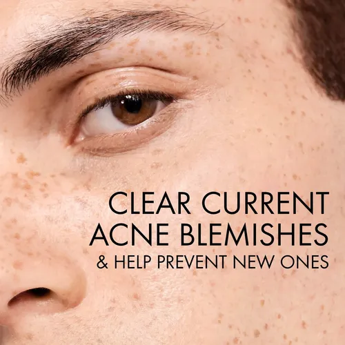 Jabón Facial Vichy Normaderm Daily Acne 0,5% De Ácido Salicí
