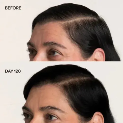 Trio Cuidado De Cabello De Vegamour Gro & Hydr-8