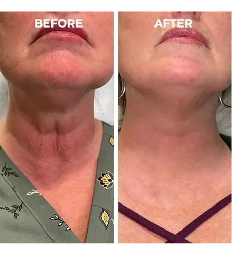 Sérum Facial Para Tensar Y Firmar