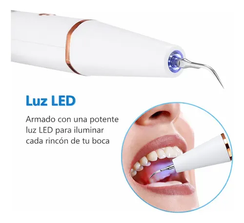 Removedor Cepillo Eléctrico Sónico Elimina Sarro Dental Oral