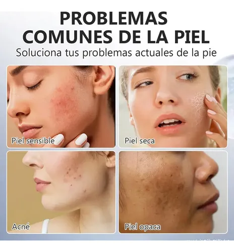 Crema De Ácido Kójico Para Manchas Y Piel Opaca