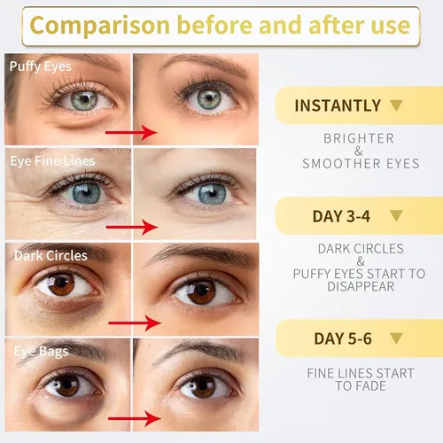 Nazano Parches Para Los Ojos De 24 Quilates Para Debajo Ojos