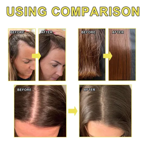 Aceite Capilar Hoegoa Para Cabello Seco Y Encrespado