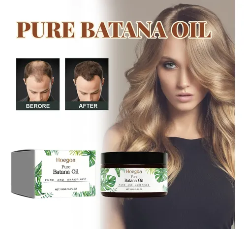 El Aceite Para El Crecimiento Del Cabello Hoegoa Batana Nutr