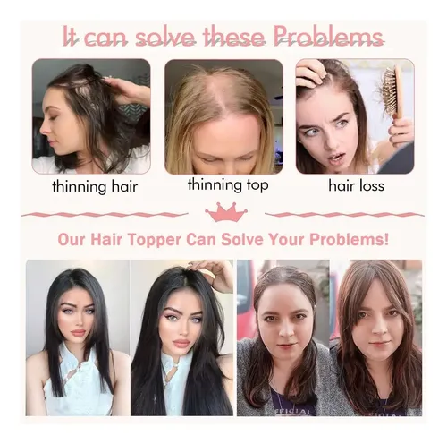 Toppers De Cabello 18 Para Mujeres Con Pelo Fino