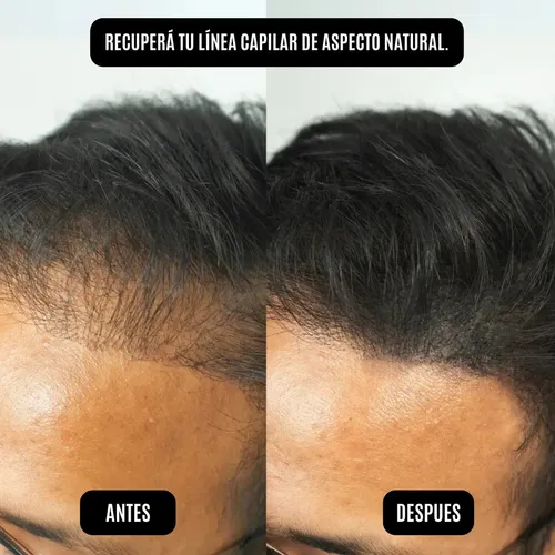 Polvo Capilar Hairgo Negro – Premium Resiste Agua Sudor