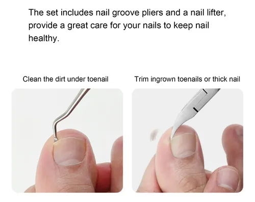 Kit De Herramientas Para Uñas Encarnadas, Pinzas Y Más