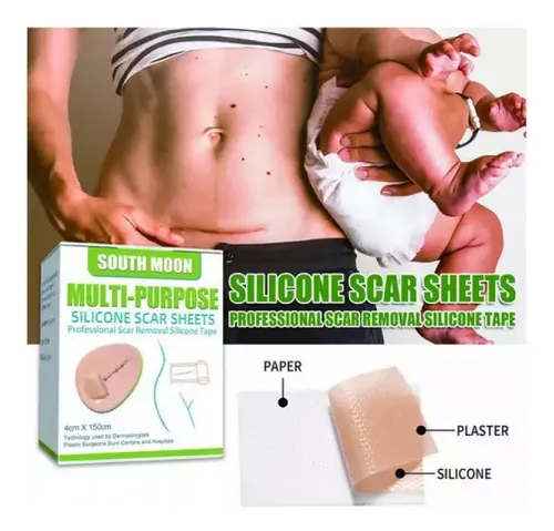 # Lámina De Silicona South Moon Para Cicatrices