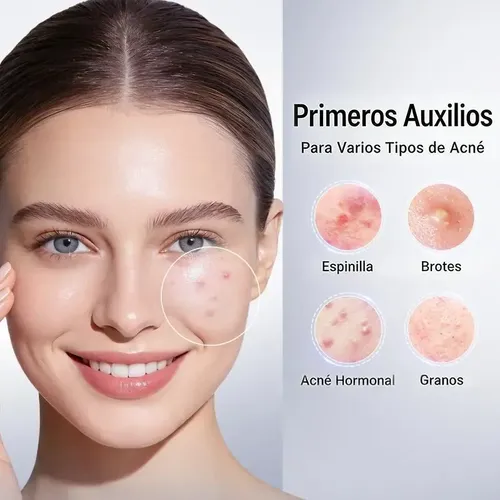 Loción Para El Cuidado De La Piel Con Tendencia Al Acné